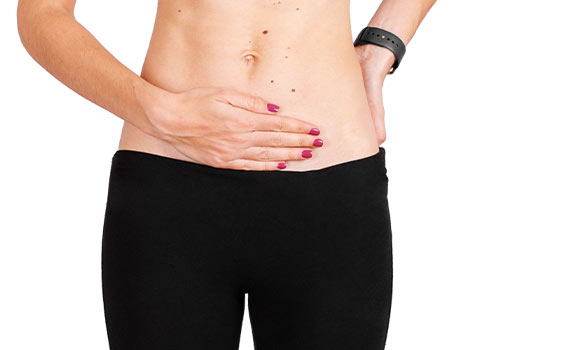 Hymenoplasty in Hyderabad